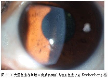 ZY016_158_2.gif